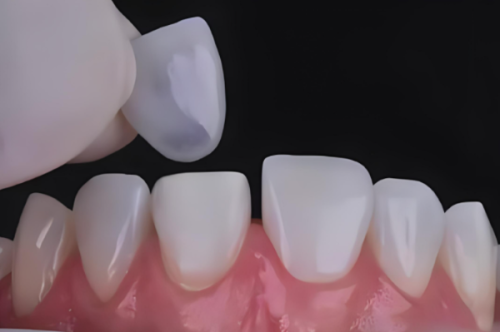 武汉德韩口腔医院是正规的吗？正规口腔机构资质齐全，技术靠谱服务还好 