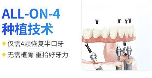 总结:贵阳牙博士口腔医院——正规靠谱的口腔诊疗优选