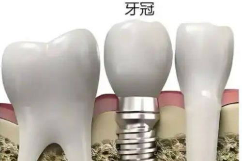 贵阳牙博士口腔医院是莆田系医院吗？其实它并非莆田系，正规靠谱口碑还不错！ 