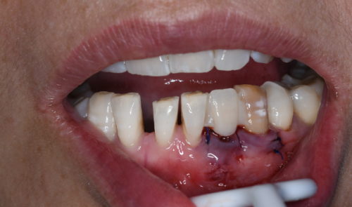 深圳金麦芽口腔医院怎么样?