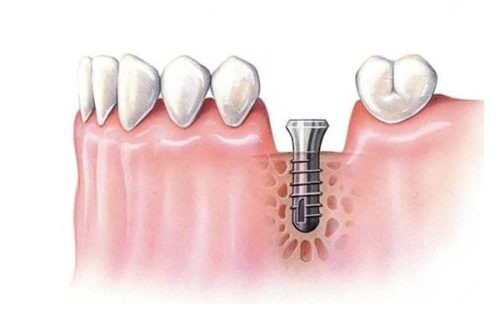 丽水亮贝美口腔门诊部:价格合理性价比高