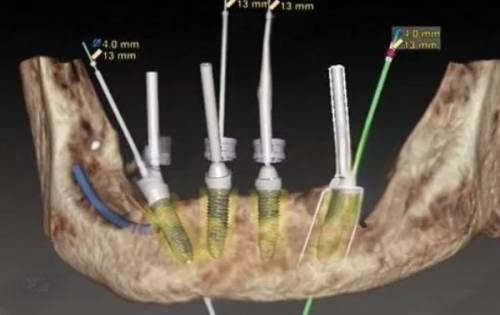 贵阳牙博士口腔医院坑不坑？看真实患者评价，揭秘这家医院的服务和技术到底咋样！ 