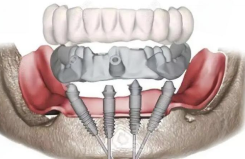 深圳同步齿科:技术好服务佳,值得信赖