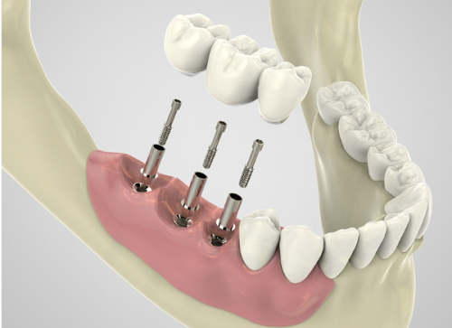 贵阳牙博士口腔是私立医院吗?3家店都是民营牙科,看下电话