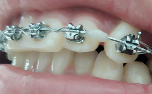 武汉德韩口腔医院:合理收费,性价比高