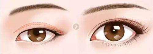 青海西宁诺贝尔口腔医院牙齿矫正项目收费情况