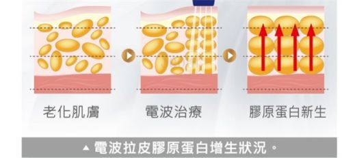 成都布莱梅联合口腔医院种植牙收费详情