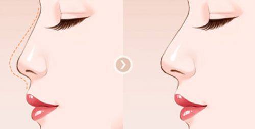 乌鲁木齐牙博士口腔2025年牙冠修复及其他项目价格表