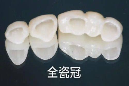 重庆团圆口腔医院：网友真实评价，服务贴心周到