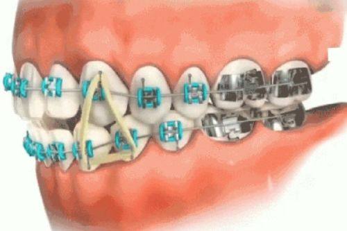 北京美冠塔口腔价格表来了！含多种口腔项目收费情况，让你看牙消费心中有数 