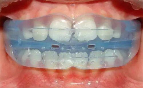 重庆齿齿美口腔适合哪些人群？