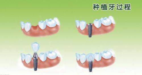 深圳格伦菲尔是莆田企业吗？深圳格伦菲尔口腔规模大有优势