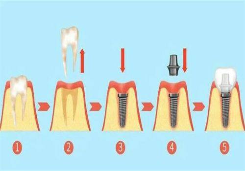 上海拜博口腔医院靠谱吗?正规可靠大型连锁牙科|分院多市民就近看诊|种牙/矫牙/儿牙/牙周病好还实惠