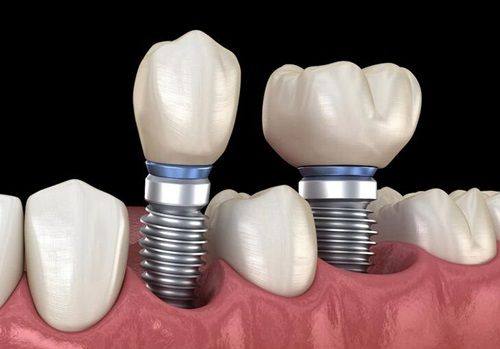 上海拜博口腔医院值得信赖吗？医生团队、设备，口腔诊疗有保障超靠谱 
