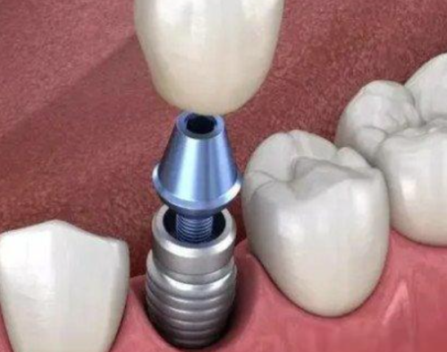 深圳格伦菲尔口腔口碑怎么样?评论说虽是私立但正规靠谱哟