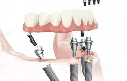 北京美冠塔口腔价格表来了！揭秘口腔项目收费情况，让你看牙消费明明白白！ 