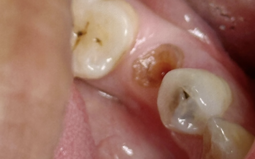 芜湖中诺口腔医院可靠吗?国内连锁牙科/质量放心/服务舒心