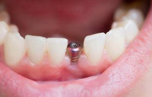 北京美冠塔口腔基础治疗项目价格