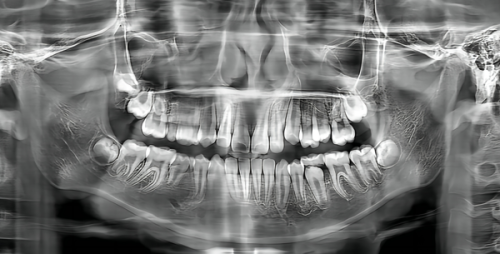 北京劲松口腔医院收费标准怎么样？合理亲民，满足不同需求还提供优质服务！ 