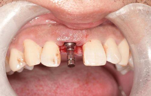 武汉优益佳口腔与同行收费对比优势尽显