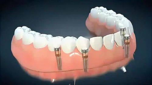 西安中诺口腔医院:价格合理性价比高