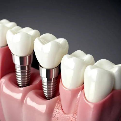 北京美冠塔口腔吸附性义齿项目价格