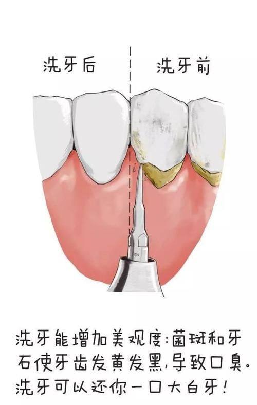 重庆齿齿美口腔的服务细节亮点多