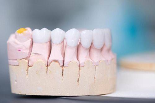 荆州中诺口腔医院的价格贵吗？消费透明吗？