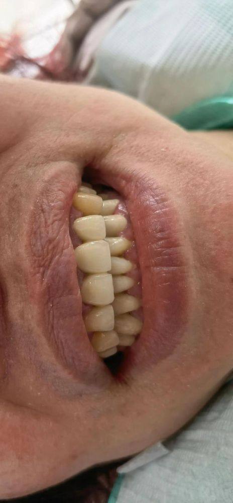 西安中诺口腔医院收费贵吗?价格透明又亲民