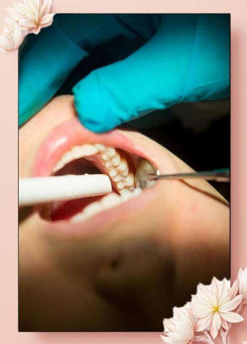 上海鼎植口腔门诊部的性价比优势