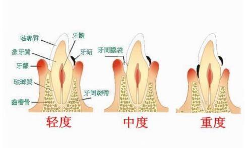 天津美奥口腔医院：合理的收费标准
