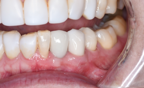 沈阳馨格口腔门诊部：合理透明的收费标准