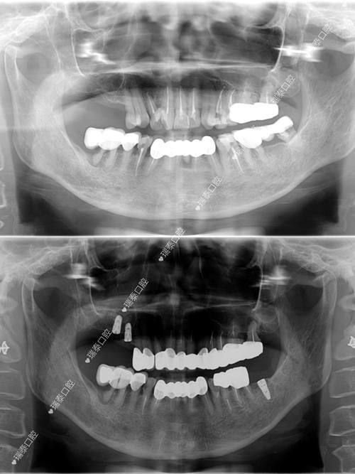 大连米嘉口腔价格表大揭秘