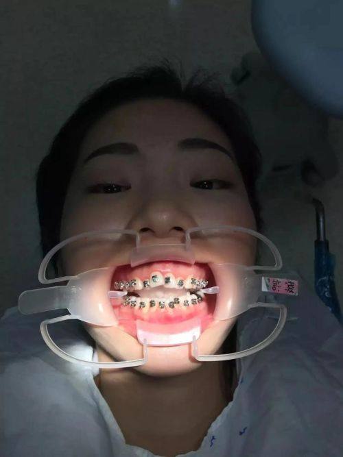 北京倍乐口腔门诊部是正规的吗？正规靠谱有资质，多项口腔医美项目都能放心做 