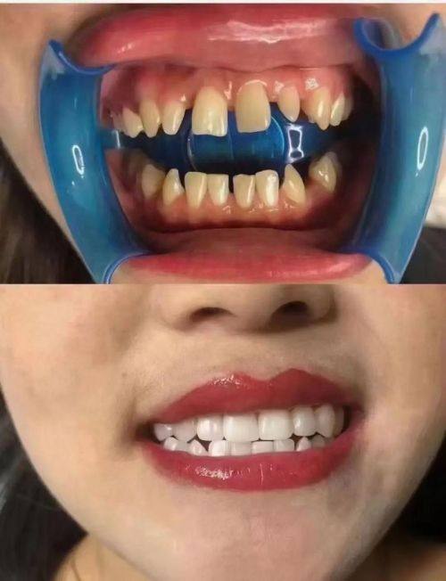 吉林市张杰口腔医院患者口碑