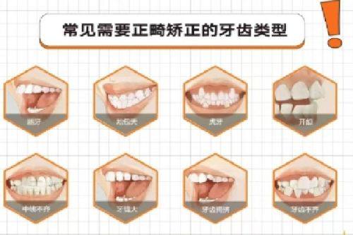 福建泉州安溪县艾美口腔坑不坑？正规资质医生靠谱，服务好体验佳不坑人！ 