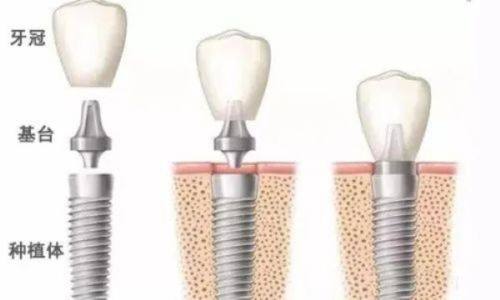 辽宁沈阳德立联合口腔医院收费透明合理