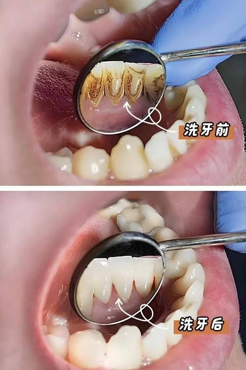 辽宁沈阳德立联合口腔医院医生团队技术不错
