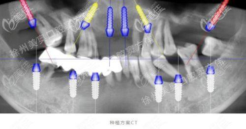 福州晶特尔齿科擅长项目: