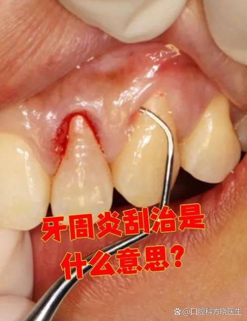 丁国明医生擅长领域：