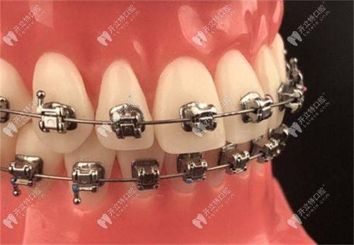 宝鸡美皓口腔岐山门诊部擅长项目：