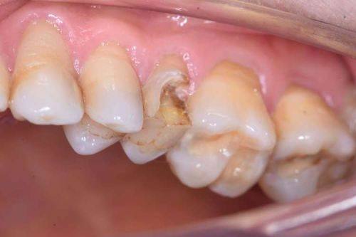 杭州萧山奈斯口腔擅长项目：