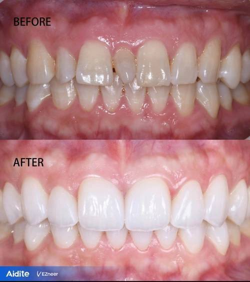 北京芒果口腔怎么样？