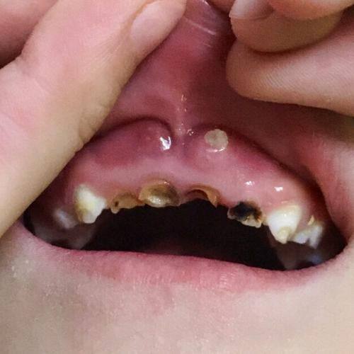 杭州萧山奈斯口腔怎么样？