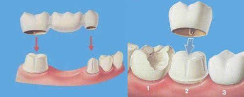 浙江嘉兴顾叶青口腔诊所地址电话及营业时间