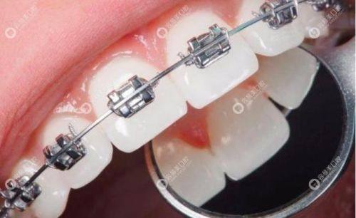 山东泰安牙博士口腔地址电话及营业时间：