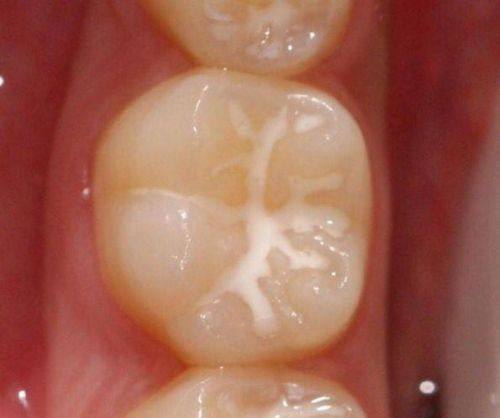 琼海光华海医口腔门诊部预约挂号方式