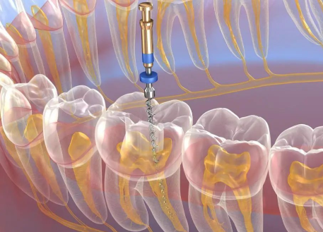 重庆美仑美奂口腔怎么样？
