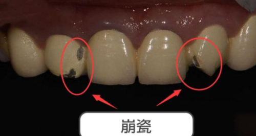 济南历下百可瑞口腔诊所擅长项目