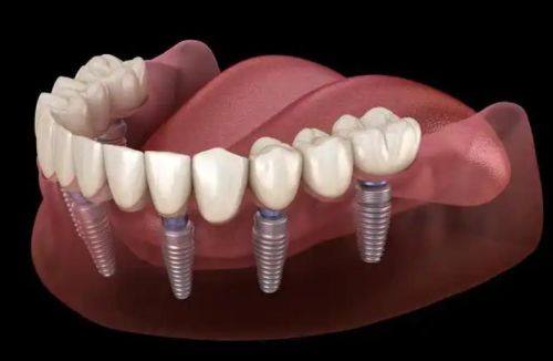 福建龙岩卢四珍口腔价格表：